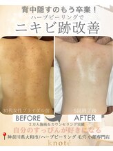 ノット(knote)/衝撃ビフォアフ2