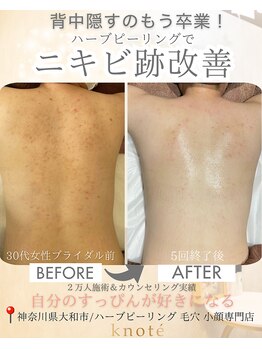 ノット(knote)/衝撃ビフォアフ2