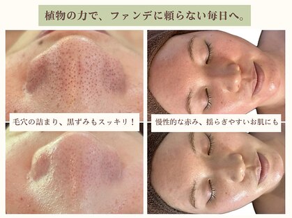 ハミングスキン(Humming skin)の写真