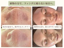 ハミングスキン(Humming skin)