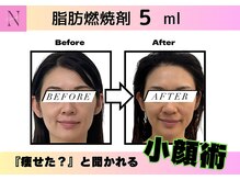 オーク ナチュリ 成城学園前(OAK×NACHUL)/【小顔】‐3Kg見えの小顔技術