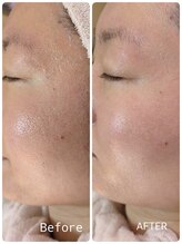 ラヴィアンローズ 蒲郡店(& La vie en Rose)/毛穴ケア