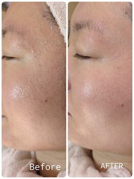 ラヴィアンローズ 蒲郡店(& La vie en Rose)/毛穴ケア