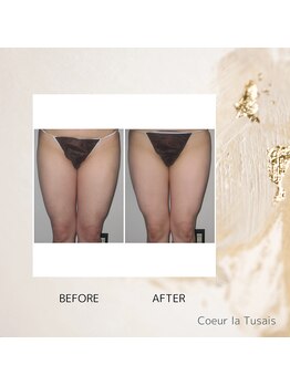 クーラ テュセ(Coeur la Tusais)/下半身集中痩身