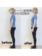 リバイブ 五反田店(REVIVE)/マッサージ/姿勢矯正5回施術