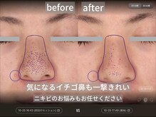 ダイヤモンドトゥルース(Diamond truth)の雰囲気（ツルツル陶器肌も夢じゃない。）
