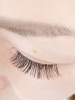 フィーネ ヴァレンテ アルプス通り店/*施術イメージ*