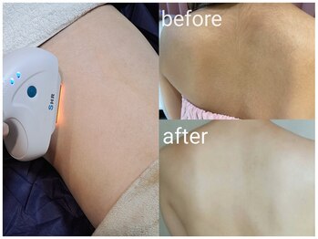 アースコアフュールボーテ ひたち野うしく店(EARTH coiffure beaute)/全身脱毛で女子力UP☆