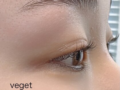 ベジ(vege t)の写真