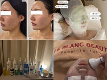 ルブランビューティー 麻布十番(Le blanc beauty)