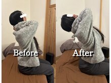 黒田鍼灸治療院/背骨の硬さとフェイスライン