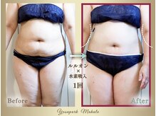 ヨサパーク マハロ 大船笠間口店(YOSA PARK Mahalo)/ビフォーアフター