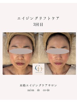 サロンドコーデ(salon de co-de)/エイジングリフトケア