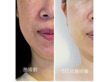 アリビオ(alivio)の雰囲気(極力、お肌に圧や摩擦を加えずに施術します。)