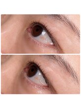 ヴァーチュープラス(VIRTUE PLUS)/