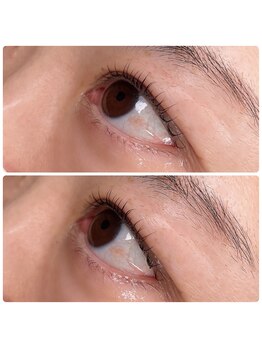 ヴァーチュープラス(VIRTUE PLUS)/