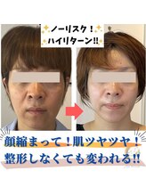 ユウェール(JUWEEL)/肌のゴワつきと毛穴の改善♪