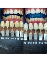 トウキョウスワーズ 池袋店(TOKYO SWRS)/#ホワイトニング #池袋 #渋谷