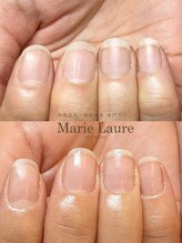 マリーロール 淀屋橋本店(Marie Laure)/自爪育成/深爪矯正/ネイルケア