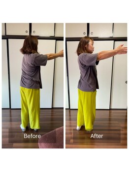 ミントのかべの整体院/施術ビフォーアフター