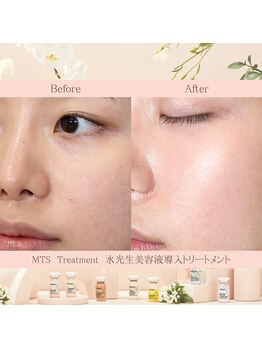 リア(lia)/韓国肌管理