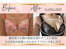 リーズリアン(Rises Lien)/【BeforeAfter】30代 バストUP!