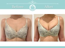 美人バスト 山梨店/【バストアップ・育乳】★症例★