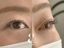 ムニ(muni)/&healthy【アンドヘルシー】