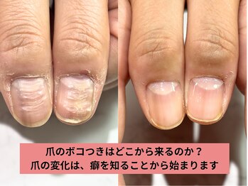 アリエ(allie)/こんな私でも出来たんだ！の感動