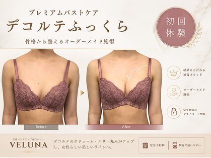 ヴェルナ(VELUNA)の写真