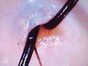 セラピエール プラス(PLUS)/すっきり!毛穴から元気な髪へ