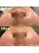 トワエクレ(toi e'clat)/スペシャルコース☆