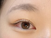 レナータ(RENATA)/ダブルアイリフト