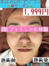 ハニーアイズ(Honey Eyes)/【BBLフェイシャル体験】
