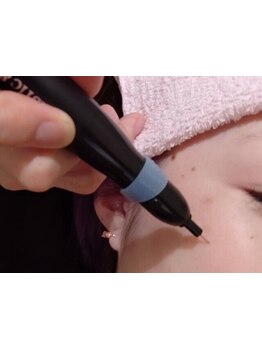 お肌をきれいにしたい