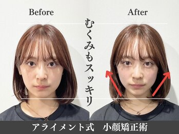 アライメントトウキョウ 表参道(Alignment TOKYO)/むくみの改善♪