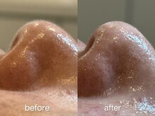 リコ ヘアアンドリラクゼーション(LICO)/フェイスワックス