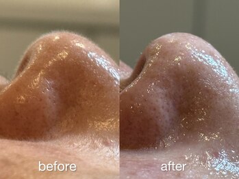 リコ ヘアアンドリラクゼーション(LICO)/フェイスワックス