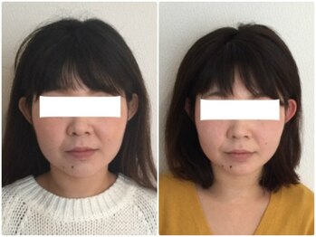 ウェリナ平和堂長久手院/小顔矯正/骨盤矯正/美脚サロン