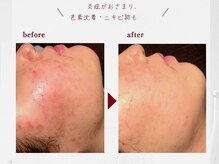 サロンドゥレーヴシエル(Salon de reve Ciel...)の雰囲気（お肌の土台の根本からケアし、くり返す肌トラブルにアプローチ◎）