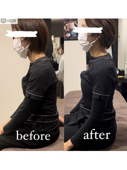 スパチャーレ(Spa ciare)/【骨盤矯正&猫背矯正】