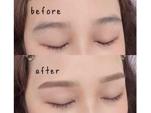 ヒース(Heath)/before＆after