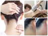 【人気部位のセット脱毛】★うなじ＋首周り＋背中★美肌脱毛　保湿ケア付き　
