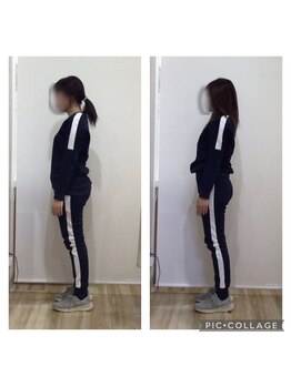 はぴねす鍼灸整骨院 玉造院/姿勢矯正