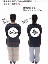 カナウ接骨院(Kanau接骨院)/産後ケアビフォアフ