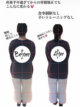 カナウ接骨院(Kanau接骨院)/産後ケアビフォアフ