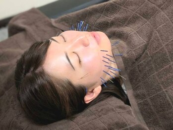 カンワ美容鍼灸院(KANWA美容鍼灸院)の写真/小顔矯正+美容鍼に不純物を流すマッサージでムクミ解消!鍼の前にマッサージをするのでお肌の負担が最小限