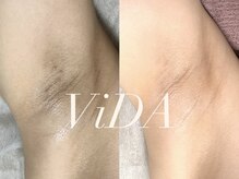 ヴィーダ 渋谷松濤(ViDA)の雰囲気（千葉・埼玉・神奈川・茨城・静岡からもご来店中★）
