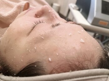 ベティ(Betty)の写真/韓国式ピーリングで憧れの艶肌へ◇LA LESS TENで本気の肌質改善を★あなたの素肌が輝き出す,新しい美の扉を