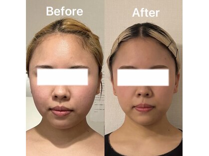 ハイコガオ 中崎町店(HIKOGAO)の写真